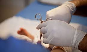 tiểu phẫu cắt bao quy đầu